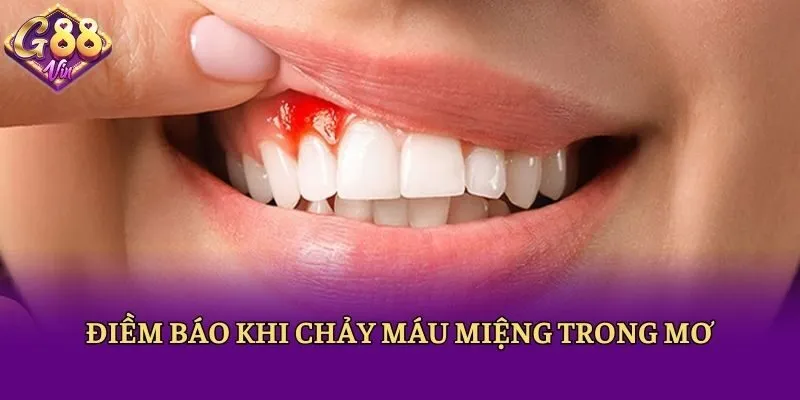 Nằm Mơ Thấy Máu Là Điềm Gì? Chốt Con Lô Đề Nào Chuẩn? - CAXON.TOP